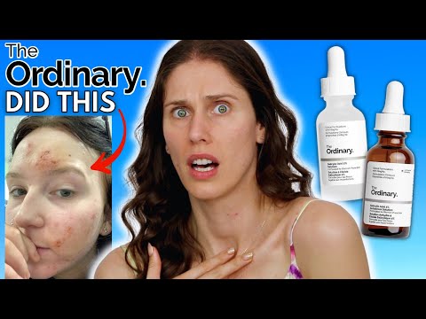 WHAT HAPPENED TO THE ORDINARY'S  SALICYLIC ACID?! VS THE NEW SALICYLIC ACID ANHYDROUS SOLUTION