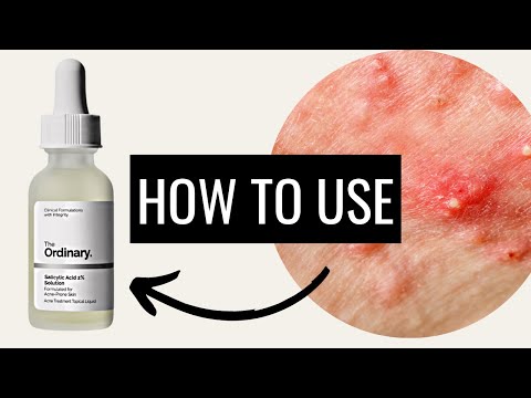 How To Use The Ordinary Salicylic Acid 2% Solution How To Use The Ordinary Salicylic Acid 2% Solution